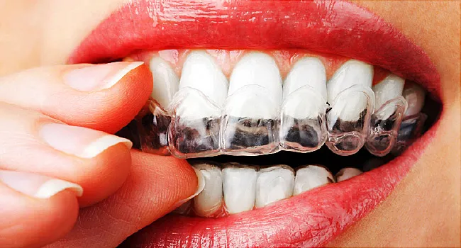 Teeth Whitening Tips To Get Rid Of Yellow Teeth