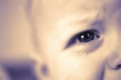 At 7 months, study finds difference in eye