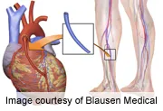 Three studies find no differences in outcomes,