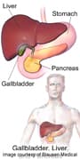 People with non-alcoholic fatty liver disease