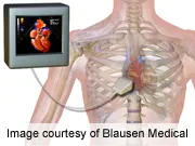 Most echocardiograms don't change patients' care,