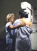 Mammograms should begin at age 40, researcher