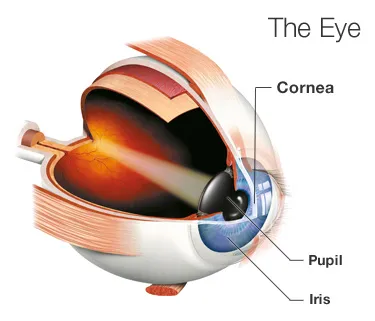 What To Do When Your Cornea Is Scratched