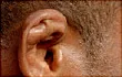 Ear Infections Causes
