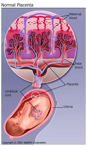 Placenta Previa Causes, Symptoms, Treatments