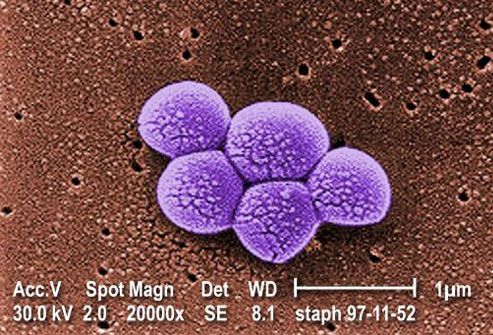 mrsa  infection causes
