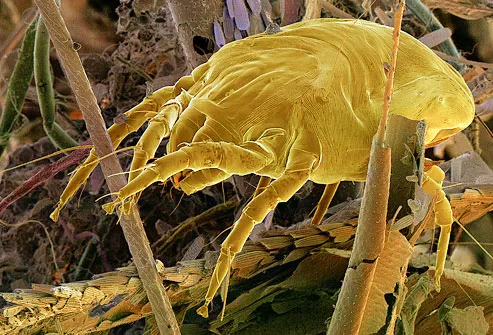 Photo of dust mite scavenging through a dust ball