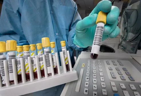 testing blood sample