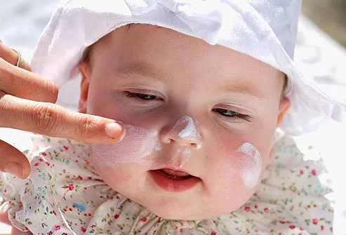 Baby Skin-Care: Simple Tips to Keep Baby's Skin Healthy in Pictures