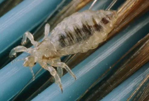 In hair — that's where you'll find lice. They like to hide in the neck area 