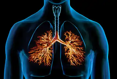 Steroid treatment for acute bronchitis