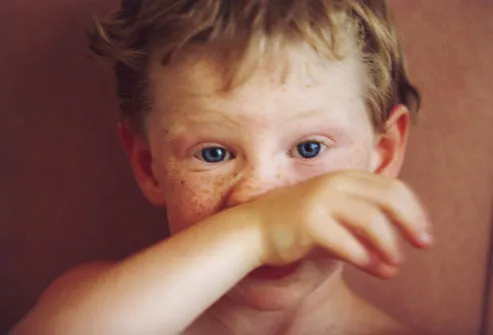 Childhood Illnesses Every Parent Should Know