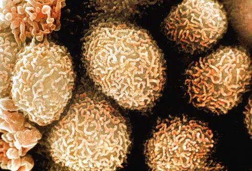 SEM micrograph of colon cancer cells