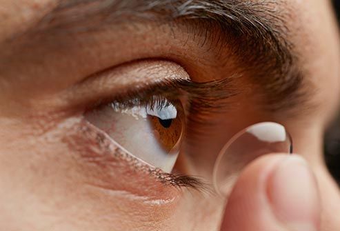 What are some ways to retrieve a contact lens lost in the eye?