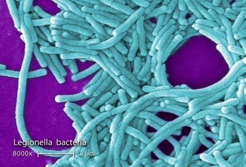 sem scan of legionella bacteria