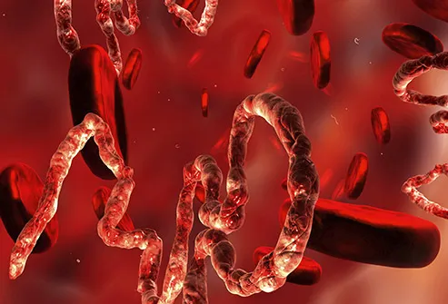 virus ebola dalam aliran darah