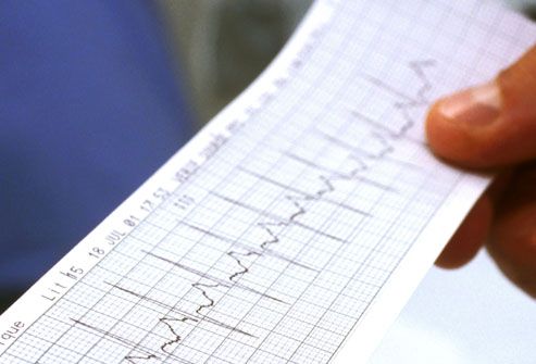 Men Heart Attack Symptoms. The researchers say all men