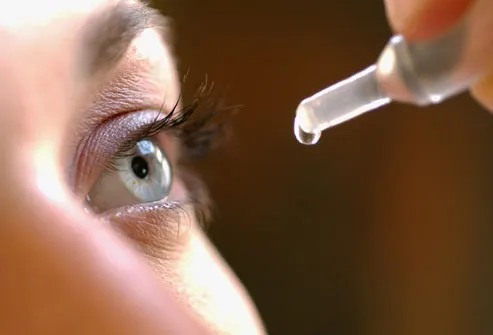 Woman Using Prescription Eye Drops