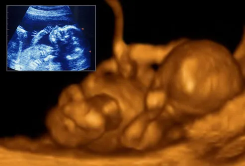 4D (3D in realtime) and standard ultrasound images