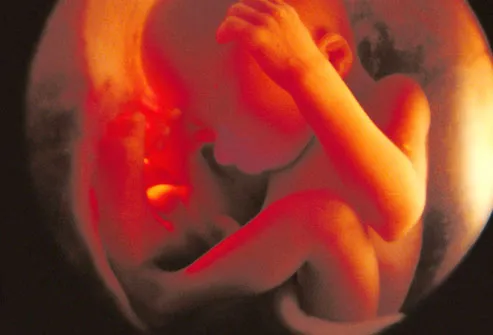 Photo of fetus in utero at 28 weeks