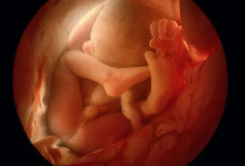 Photo of fetus in utero at 36 weeks