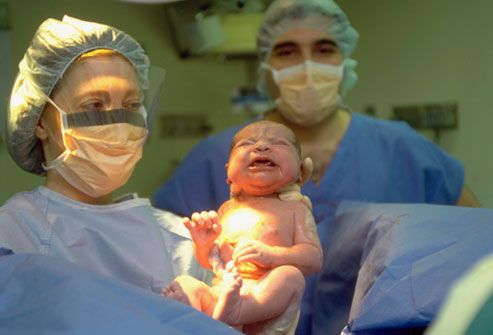 Newborn baby at birth