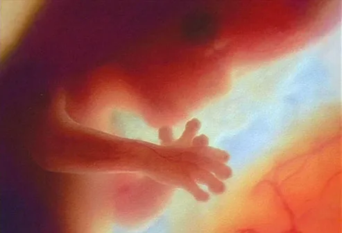 Human fetus in utero at 12 weeks