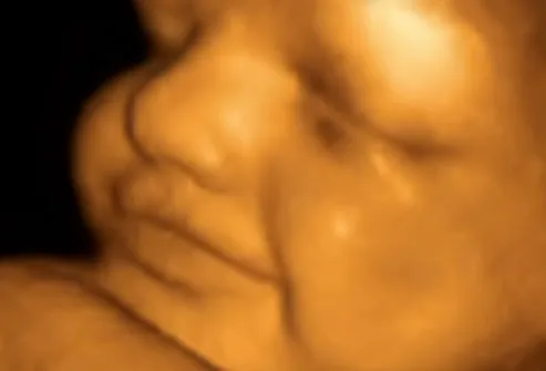 4D ultrasound of 24-week fetus