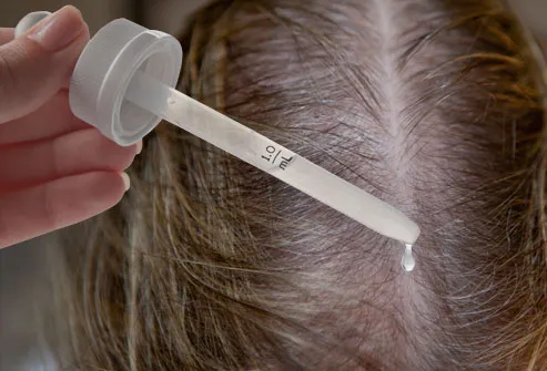 Applying minoxidil to scalp
