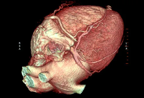 Colourised CT scan jantung manusia