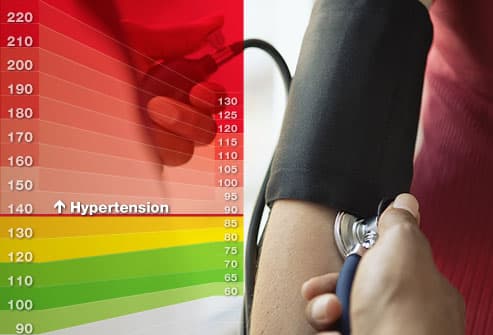 Heart attack symptoms women blood pressure