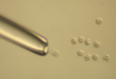 Fertilized Donor Embryos