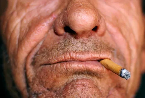 Smokers more likely to think cancer is a death sentence