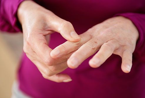 Rheumatoid Arthritis Rashes: Pictures, Symptoms, and ...