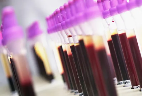 Blood Samples In Test Tubes