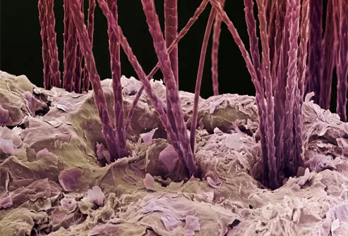 Colored scanning electron micrograph of dog hair