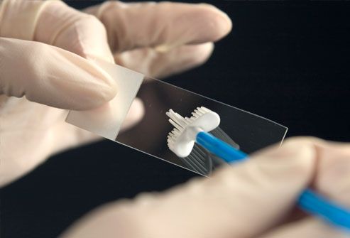 Pap Smear Screening Test