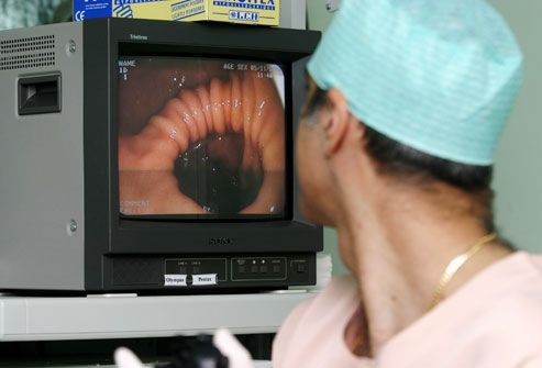 Doctor Looking at Colonoscopy on Monitor
