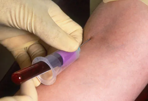 Drawing Blood From Patient