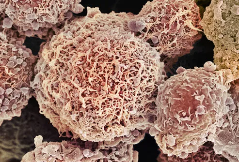 Cervical Cancer Cells