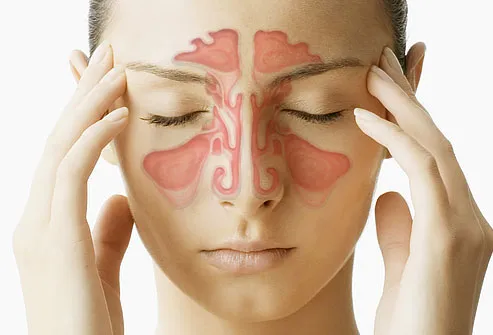 Sinus illustration superimposed on woman's face