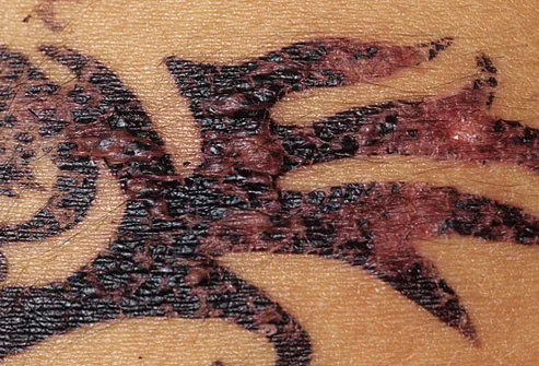 black henna tattoo. Black henna may contain the
