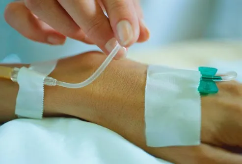 Iv steroid treatment for ulcerative colitis