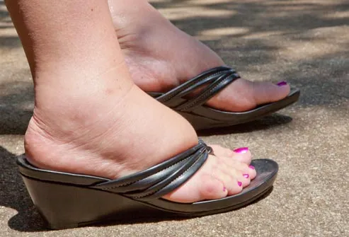 for  Pictures: shoes More Feet, women Foot problems Sore foot with Problem With Heel and Pain, Remedies
