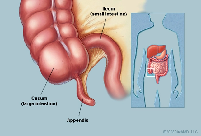 Appendix (Anatomy): Appendix Picture, Location, Definition, Function