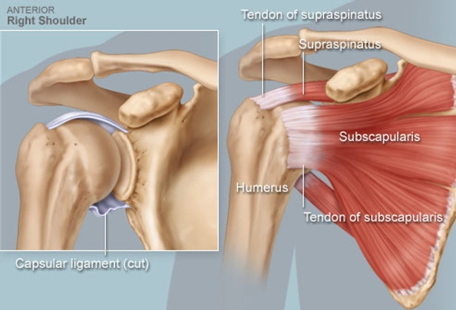 What are some symptoms of a shoulder tear?