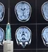 brain scan and vaccination needle