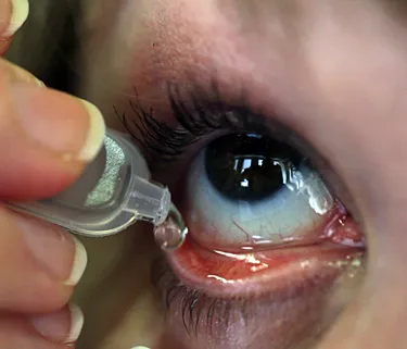 What are some common eye disorders and symptoms?