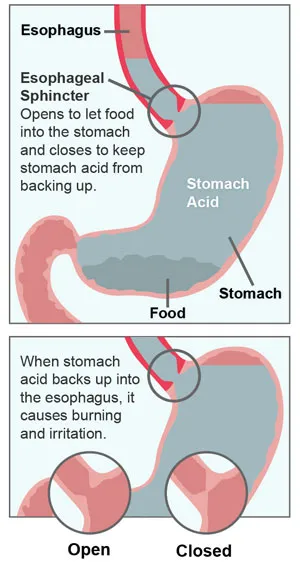 stomach diagram