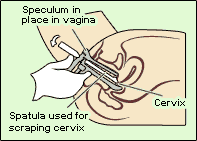 a pap test